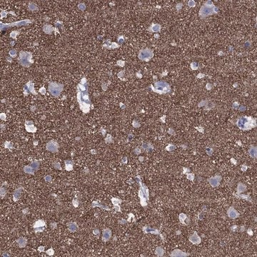 Anti-Syp Antibody Produced In Rabbit Prestige Antibodies&#174; Powered by Atlas Antibodies, affinity isolated antibody, buffered aqueous glycerol solution