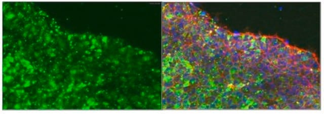 Anti-podocalyxin associated keratan sulfate, clone R-10G| MABD151 Antibody clone R-10G, from mouse