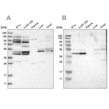 Anti-WDR53 antibody produced in rabbit Prestige Antibodies&#174; Powered by Atlas Antibodies, affinity isolated antibody, buffered aqueous glycerol solution