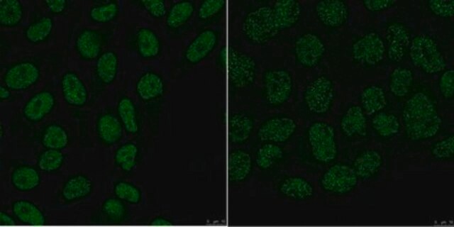 Anti-ARID1B Antibody, clone 3D9.1 clone 3D9.1, from mouse