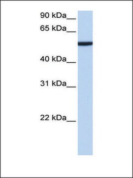 Anti-CBX2 affinity isolated antibody