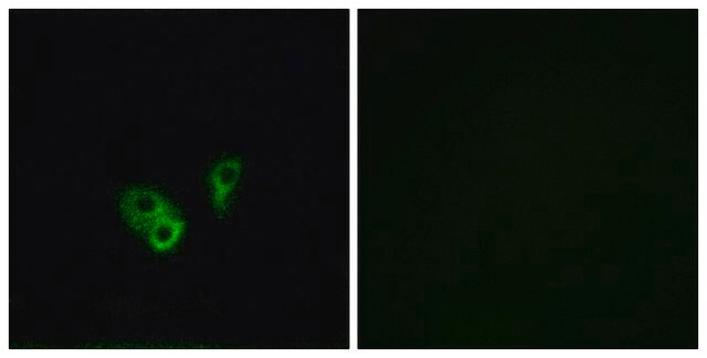 Anti-CNGA2 antibody produced in rabbit affinity isolated antibody