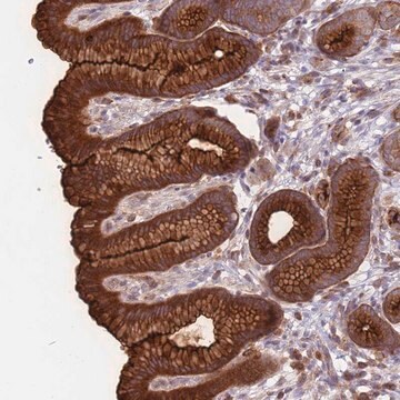 Anti-DDX19B antibody produced in rabbit Prestige Antibodies&#174; Powered by Atlas Antibodies, affinity isolated antibody, buffered aqueous glycerol solution