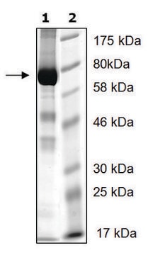 UBE3A active human recombinant, expressed in baculovirus infected Sf9 cells, &#8805;72% (SDS-PAGE)