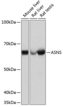 Anti-ASNS antibody produced in rabbit