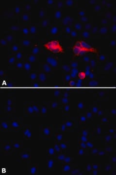 Anti-PLAUR/uPAR antibody, Mouse monoclonal clone PL231, purified from hybridoma cell culture