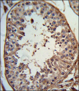 ANTI-ANGEL1 (C-TERM) antibody produced in rabbit IgG fraction of antiserum, buffered aqueous solution