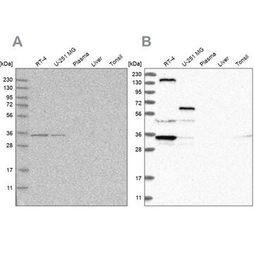 Anti-PPP1R42 antibody produced in rabbit Prestige Antibodies&#174; Powered by Atlas Antibodies, affinity isolated antibody, buffered aqueous glycerol solution, ab1