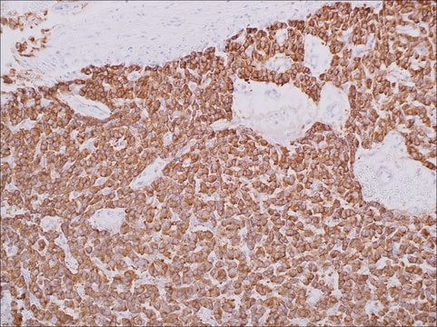 Synaptophysin (EP158) Rabbit Monoclonal Primary Antibody