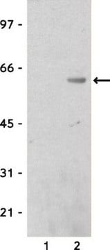 Anti-Calmodulin-Bindungsprotein-Epitop-Tag-Antikörper Upstate&#174;, from rabbit