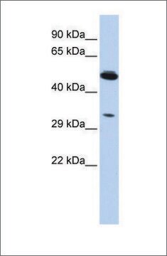 Anti-PIK3IP1 antibody produced in rabbit affinity isolated antibody