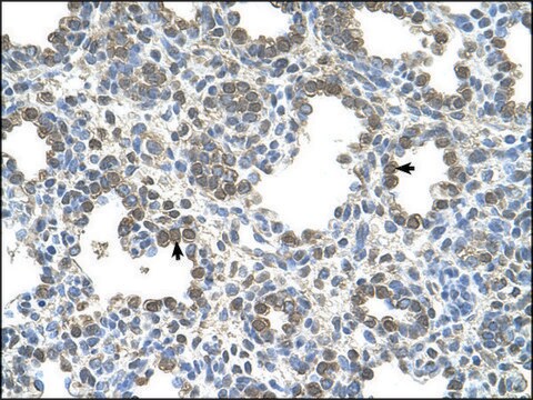 Anti-SLC26A5 antibody produced in rabbit IgG fraction of antiserum