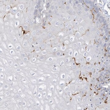 Anti-ATP13A1 antibody produced in rabbit Prestige Antibodies&#174; Powered by Atlas Antibodies, affinity isolated antibody, buffered aqueous glycerol solution