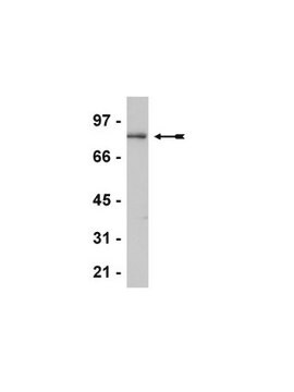 Anti-CENP-B Antibody Upstate&#174;, from rabbit