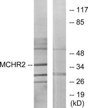 Anti-MCHR2 antibody produced in rabbit affinity isolated antibody