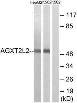 Anti-AGXT2L2 antibody produced in rabbit affinity isolated antibody