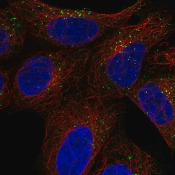 Anti-Snx27 Antibody Produced In Rabbit Prestige Antibodies&#174; Powered by Atlas Antibodies, affinity isolated antibody, buffered aqueous glycerol solution