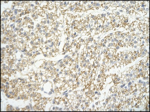 Anti-LSM4 antibody produced in rabbit affinity isolated antibody