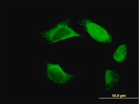 Anti-FERMT3 antibody produced in mouse IgG fraction of antiserum, buffered aqueous solution