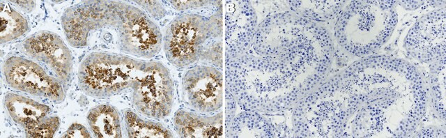 Anti-PABP-1 Antibody, clone 1D5 ZooMAb&#174; Rabbit Monoclonal recombinant, expressed in HEK 293 cells