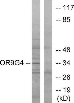 Anti-OR9G4 antibody produced in rabbit affinity isolated antibody