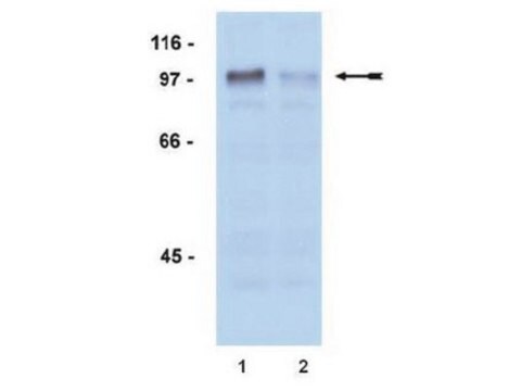 Anticuerpo anti-fosfo-receptor de andrógenos (Ser81), monoclonal de conejo culture supernatant, Upstate&#174;