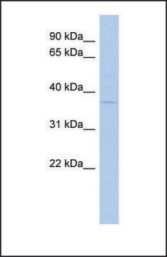 Anti-MARCH5, (N-terminal) antibody produced in rabbit affinity isolated antibody