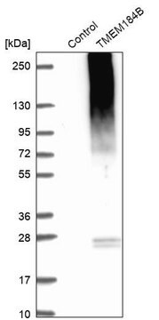 Anti-TMEM184B antibody produced in rabbit Prestige Antibodies&#174; Powered by Atlas Antibodies, affinity isolated antibody, buffered aqueous glycerol solution