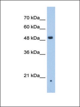 Anti-ZDHHC16 antibody produced in rabbit affinity isolated antibody