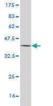 Monoclonal Anti-AADAC antibody produced in mouse clone 2E8, purified immunoglobulin, buffered aqueous solution