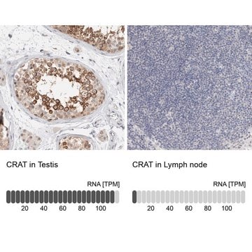 Anti-CRAT antibody produced in rabbit Prestige Antibodies&#174; Powered by Atlas Antibodies, affinity isolated antibody, buffered aqueous glycerol solution, Ab1