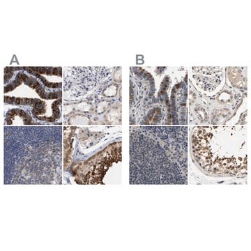 Anti-RUVBL1 antibody produced in rabbit Prestige Antibodies&#174; Powered by Atlas Antibodies, affinity isolated antibody, buffered aqueous glycerol solution