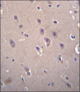 ANTI-DLL3 (C-TERM) antibody produced in rabbit IgG fraction of antiserum, buffered aqueous solution