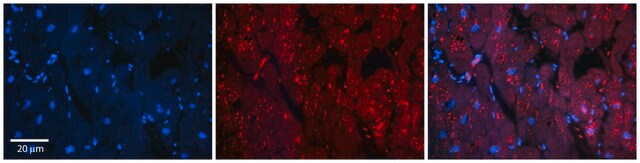 Anti-INSR antibody produced in rabbit affinity isolated antibody