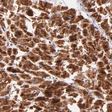 Anti-NDUFB7 antibody produced in rabbit Prestige Antibodies&#174; Powered by Atlas Antibodies, affinity isolated antibody, buffered aqueous glycerol solution