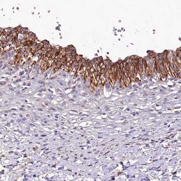 Anti-SH3TC2 antibody produced in rabbit Prestige Antibodies&#174; Powered by Atlas Antibodies, affinity isolated antibody, buffered aqueous glycerol solution