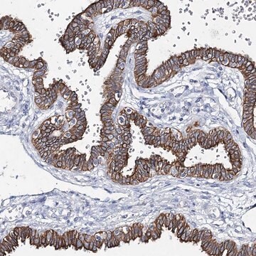 Anti-ADGRL1 antibody produced in rabbit Prestige Antibodies&#174; Powered by Atlas Antibodies, affinity isolated antibody, buffered aqueous glycerol solution