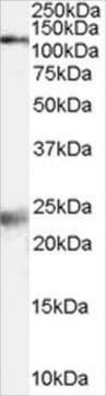 Anti-NMDA Receptor 1/GRIN1 antibody produced in goat affinity isolated antibody, buffered aqueous solution