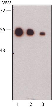 Monoclonal Anti-Cytochrome P450 3A5 antibody produced in mouse ~2&#160;mg/mL, clone F18 P3 B6, purified immunoglobulin, buffered aqueous solution