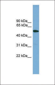 Anti-TMPRSS4 antibody produced in rabbit affinity isolated antibody