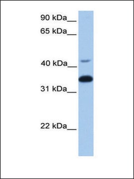 Anti-GNB2 antibody produced in rabbit affinity isolated antibody