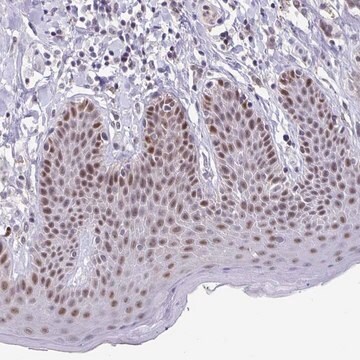 Anti-ZNF691 antibody produced in rabbit Prestige Antibodies&#174; Powered by Atlas Antibodies, affinity isolated antibody, buffered aqueous glycerol solution