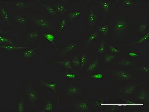 Anti-ESF1 antibody produced in rabbit purified immunoglobulin, buffered aqueous solution