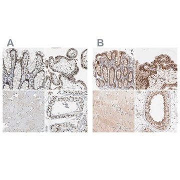 Anti-GATAD2A antibody produced in rabbit Prestige Antibodies&#174; Powered by Atlas Antibodies, affinity isolated antibody, buffered aqueous glycerol solution