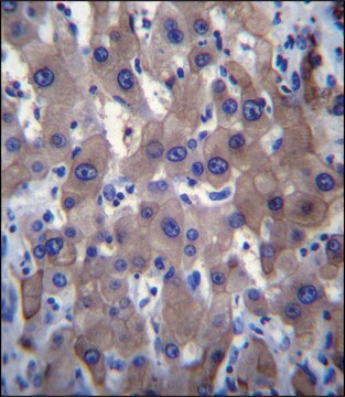 ANTI-MLXIPL (C-TERM) antibody produced in rabbit IgG fraction of antiserum, buffered aqueous solution