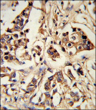 ANTI-ARHGAP18 (CENTER) antibody produced in rabbit IgG fraction of antiserum, buffered aqueous solution