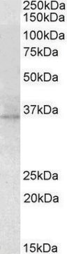 Anti-RDH5 antibody produced in goat affinity isolated antibody, buffered aqueous solution