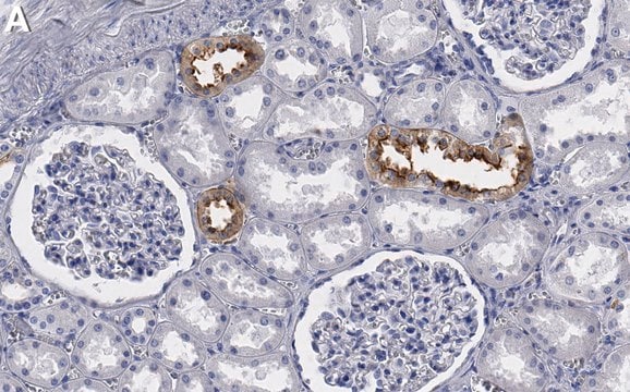 Anti-SLC12A3 Antibody, clone 3I12 ZooMAb&#174; Rabbit Monoclonal recombinant, expressed in HEK 293 cells