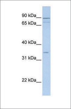 Anti-TNMD (ab1) antibody produced in rabbit affinity isolated antibody