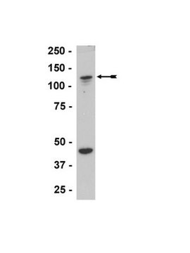 Anti-ADAP/SLAP-130/Fyb Antibody Upstate&#174;, from rabbit